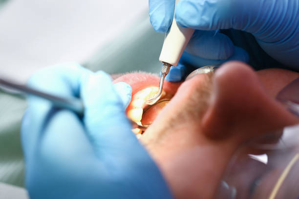 Best Pediatric Emergency Dentist in North Wales, PA