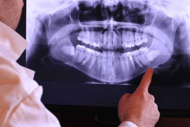 Best Broken or Cracked Tooth Emergency Dentist in North Wales, PA